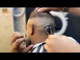 Man felt severe pain in his head when the barber sees it he runs to the doctor