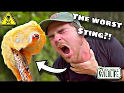 WHAT Happens IF YOU Get STUNG BY An ASP CATERPILLAR!?