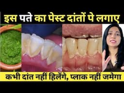 दांतों का हिलना और प्लाक जमना कैसे रोके | How To Remove Dental Plaque At Home  |