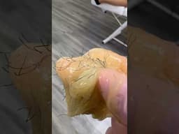 SUGARING | SUGAR WAX #waxing #hairremoval #sugarwaxing #sugarwax