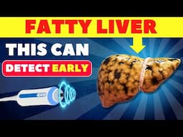 The Best 3 Tests to Detect Fatty Liver Early | Fatty Liver #fattyliver #health