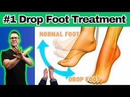 10 BEST Foot Drop Treatments & Exercises [Braces, Shoes, Orthotics]