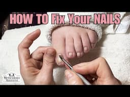 How to Make Thick Toenails Thin Again