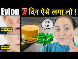 3 रूपए की चीज़ से पाए गोरी निखरी Skin हमेशा के लिए -Vitamin E se झाइयाँ Open Pores Pigmentation गायब💕