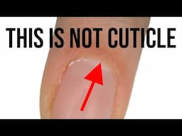 What Is Cuticle?