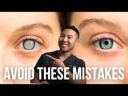 Cataract Surgery in One Eye? Avoid These 3 MISTAKES