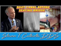 Root Canals Before Seating Dental Bridge - Dental Minute with Steven T. Cutbirth, DDS