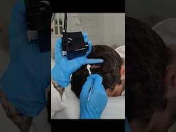 Scalp examination for sensitive skin areas