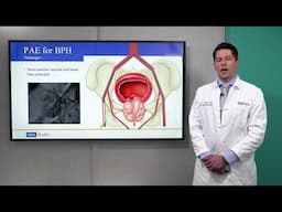 Prostatic Artery Embolization Procedure Technique | Lucas R. Cusumano, MD, MPH