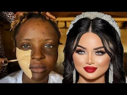 Bomb💣👉😱🔥Unbelievable Bridal Transformation 💉😳🔥😱 Makeup Tutorial