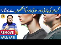 Gardan Ki Charbi & Ankhon Ki Sujan Ka Ilaj | Rid Double Chin Fat & Puffy Eyes | Dr. Ibrahim