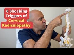 6 Surprising Causes of Cervical Radiculopathy You Won't Believe #4