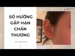 Số hưởng gặp hạn chấn thương | Xem tướng dạo #152