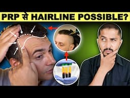 How To Regrow Receding Hairline - PRP GFC Treatment ( Things You Should know)