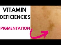 Vitamin Deficiencies  HYPERPIGMENTATION #goseechristy #shorts