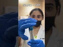 Experience the power of Nano PRP! ✨