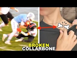 BROKEN COLLARBONE AT PLAYOFF FOOTBALL GAME! 🏈