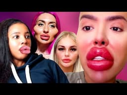 Gen Z Is Addicted To Plastic Surgery | Reaction