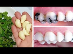 How To Reverse Cavities And Heal Tooth Decay By This Remedy