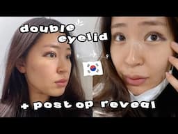 My Non-Incisional DOUBLE EYELID SURGERY in Korea | Experience, Tips, The Search, Recovery & Result