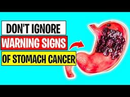 7 Warning SIGNS of STOMACH CANCER