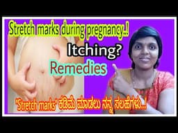 Natural remedies to reduce Itching &stretch marks during pregnancy|ಎಷ್ಟೇ ಹಳೆ stretch marks ಆದ್ರೂ ಮಾಯ