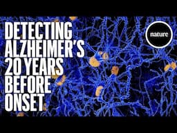 Detecting Alzheimer's 20 years before onset