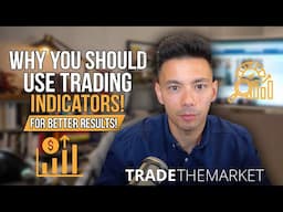 Why Every Forex Trader Should Use Indicators