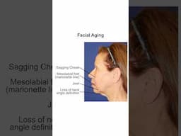 Causes of Facial Volume Loss, or Volume Deficit #facialrejuvenation