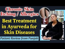 Chronic Skin Itching/ Allergy, Skin Diseases- Best Treatment in Ayurveda| Patient Review from Punjab