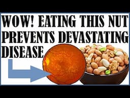 Wow! Eating This Nut Daily Prevents Devastating Disease (& It's Not Walnuts)