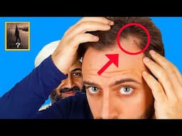 Don't want to go bald? Watch this.