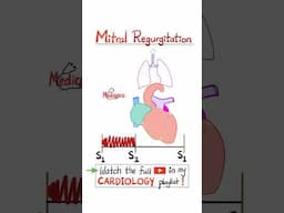 Mitral Regurgitation (MR) - Valvular Heart Disease (VHR)…#cardio #anatomy #mbbs #science #nclex