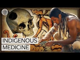 Ancient Brain Surgery: The Remarkable Medical Innovations Of Indigenous Americans