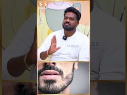 Patchy Beard இருக்கிறவங்க இதை பண்ணுங்க... Hair Artist Krishna