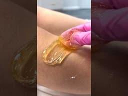 SUGARING | SUGAR WAX #waxing #hairremoval #sugarwaxing #sugarwax