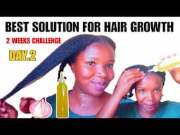 DAY 2: POWERFUL ONION OIL FOR HAIR GROWTH | 14-Day Onion Hair Growth Challenge