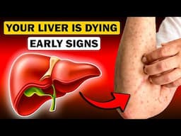 Early Warning Signs of Fatty Liver Disease (You Might Be Ignoring)