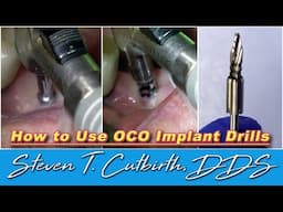 How to Use OCO Implant Drills - Dental Minute with Steven T. Cutbirth, DDS