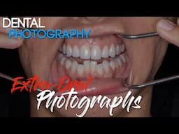 Dental Photography Basics - Dental Photography Techniques - Extra-oral Photographs