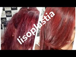 Lisoplastia