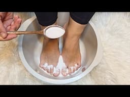 I put baking soda on my feet and look what happened !