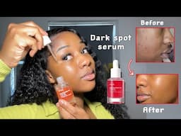 HOW TO FADE DARK MARKS AND BLEMISHES WITH ONE PRODUCT |Quick Results | *pics included* ‼️