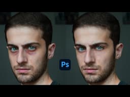 Under Eye Darkness Removal Photoshop