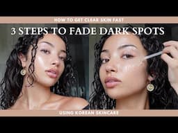 HOW TO FADE DARK SPOTS FAST | 3 steps | skincare facts & tips for acne