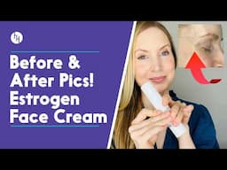 I Used An Estrogen Face Cream For 3 Months - Alloy M4 Review