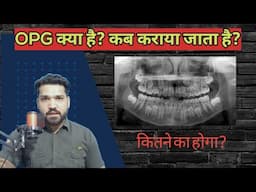 OPG / मुँह का बड़ा x-ray क्या होता है? कब कराया जाता है? कितने रूपए लगेंगे??