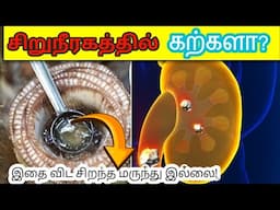 இவற்றை சாப்பிட்டாலே போதும் சிறுநீரக கல் இனி வராது | Best Home Remedies for Kidney stones in tamil