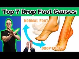 What Is Drop Foot & Top 7 Foot Drop Causes [Home Diagnosis]