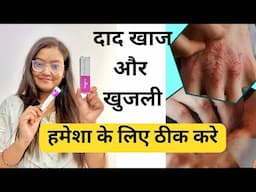 दाद खाज और खुजली को हमेशा के लिए ठीक करने वाली क्रीम | lulibex cream